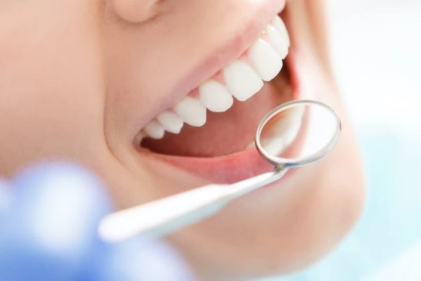 Teeth Whitening Teeth Whitening