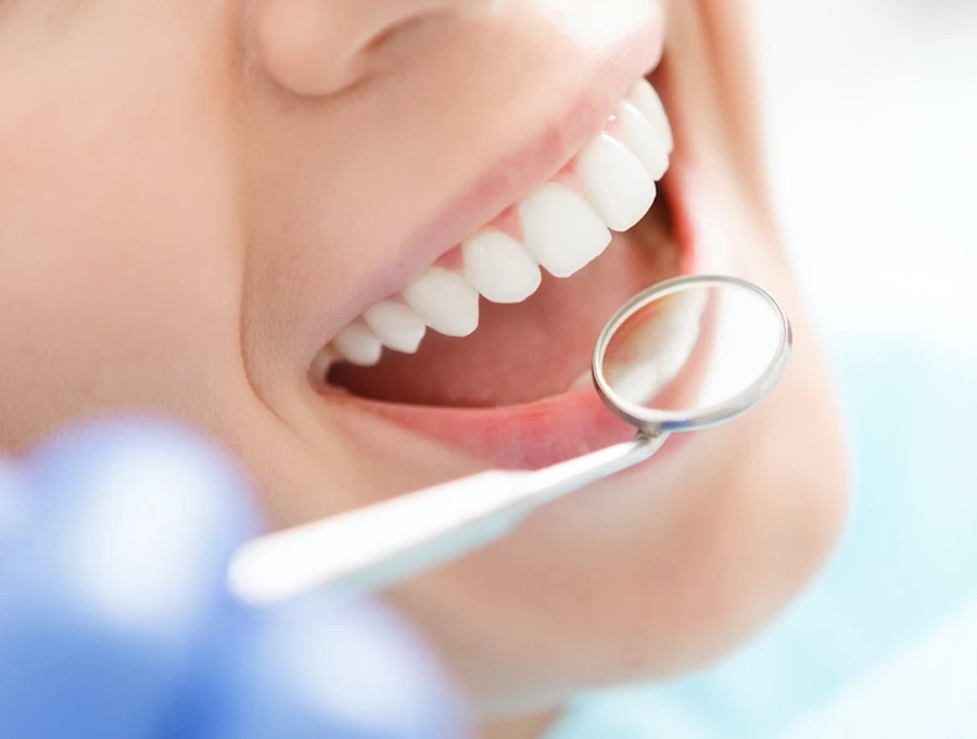Teeth Whitening Teeth Whitening