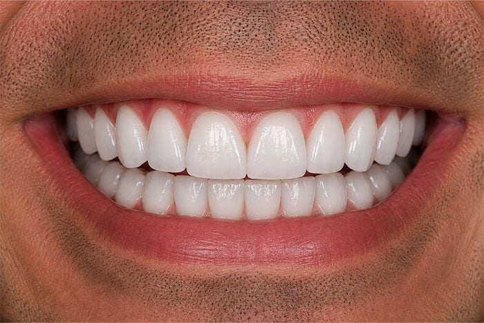 Close-up of a bright, even smile