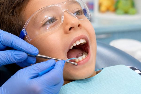 Protective-dental-sealants